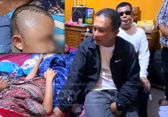 Viral Penganiayaan di Kuningan Siswa Kelas 9 Harus Operasi Kepala, Bupati Turun Tangan